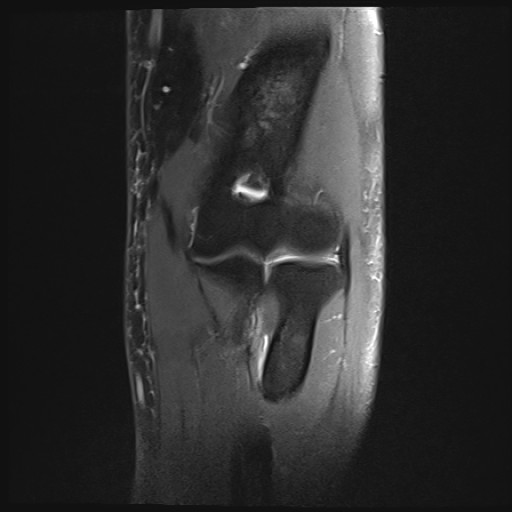 Click on the Serie image to view the images of Wieszt, Gnter